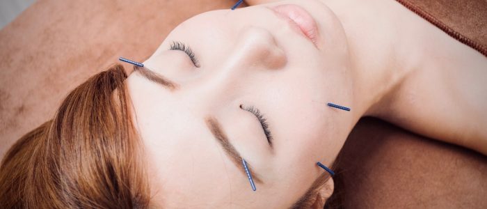 How to get ready for an acupuncture treatment