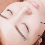 How to get ready for an acupuncture treatment