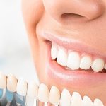 Know more about Dental crown in singapore