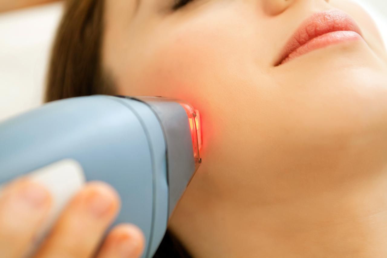 The Excellent Benefits of Getting Infini Laser Treatments