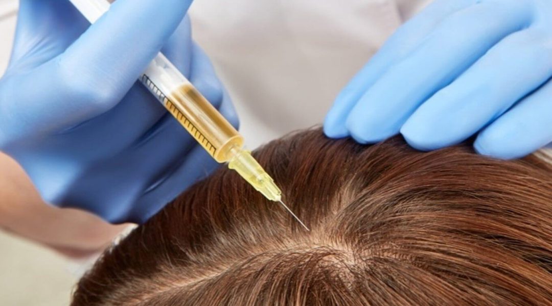 Need an affordable scalp treatment in Singapore? Look no further than Two Herbs.